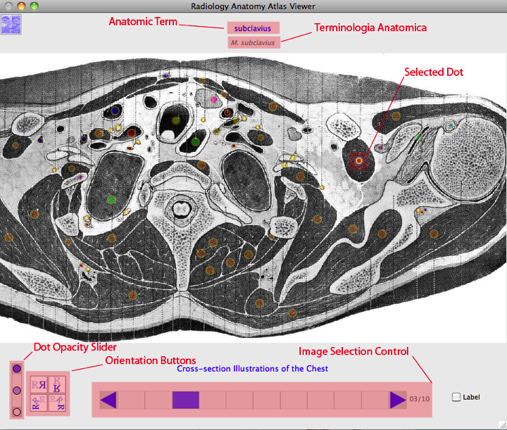 RAAViewer Specific Picture